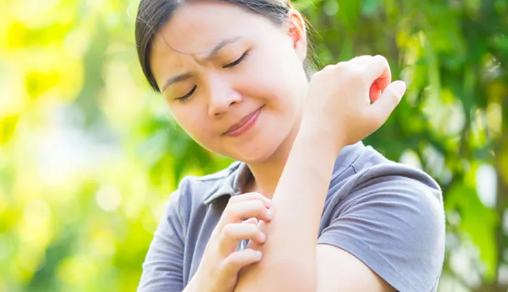 Woman with psoriasis on her skin scratching her arm.