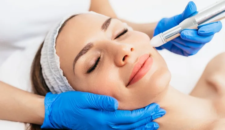 A woman receives a professional microneedling treatment.